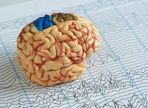 Groundbreaking implant could treat seizures before they happen